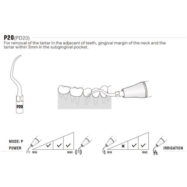Punta ultrasonidos Woodpecker P20 compatible EMS | Perio - Imagen 2