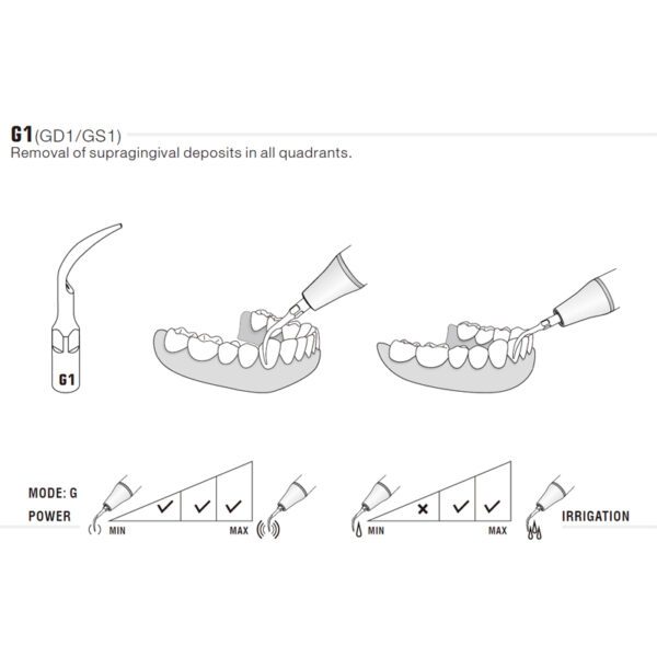 Punta ultrasonidos Woodpecker G1 compatible EMS | Profilaxis - Imagen 3