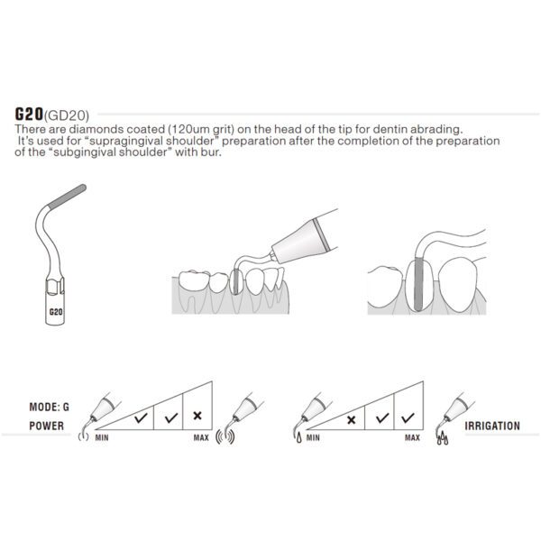 Punta ultrasonidos Woodpecker G20 compatible EMS | Profilaxis, Tallado Diamantada - Imagen 3