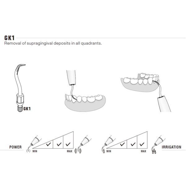 Punta universal para KaVo Sonicflex 2000N / 2003 y ECO S2 | Profilaxis - Imagen 2