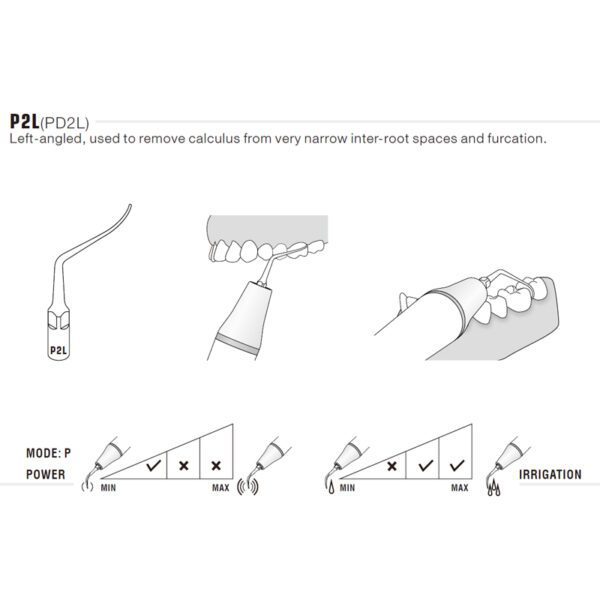 Punta ultrasonidos Woodpecker DTE PD2L Rosca tipo S | Perio (lado izquierdo) - Imagen 4