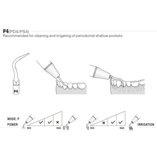 Punta ultrasonidos Woodpecker PD4 compatible Satelec | Perio - Imagen 2