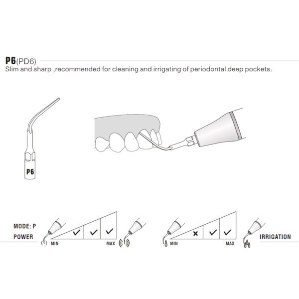 Punta ultrasonidos Woodpecker PD6 compatible Satelec | Perio - Imagen 3