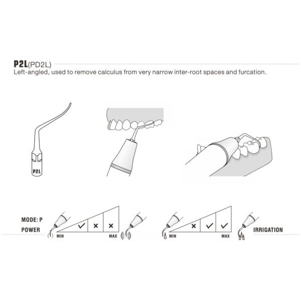 Punta ultrasonidos Woodpecker P2L compatible EMS | Perio (lado izquierdo) - Imagen 4