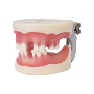 Tipodonto para implantologÃa con articulador Bader