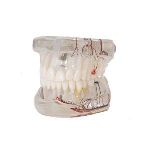 Modelo de implante con nervio Bader