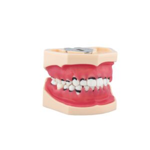 Modelo de Periodoncia Completo Bader