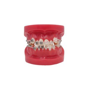 Modelo de Bracket Metálico y zafiro Bader