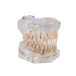 Macromodelo Bader con Patología Completa