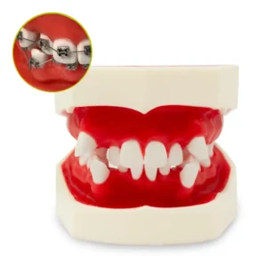 Tipodonto Ortodoncia Cementada y Biomédica Bader